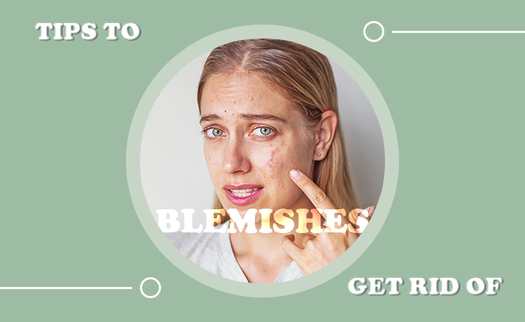 Tips For Getting Rid Of Blemishes Blog Featured Image