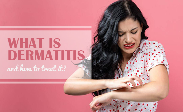What Is Dermatitis And How To Treat It Blog Featured Image