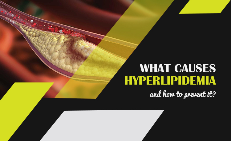 Hyperlipidemia Causes And How To Prevent It Blog Featured Image