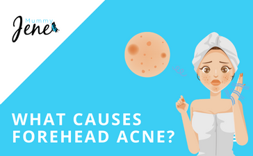 Learn What Causes Forehead Acne Blog Featured Image