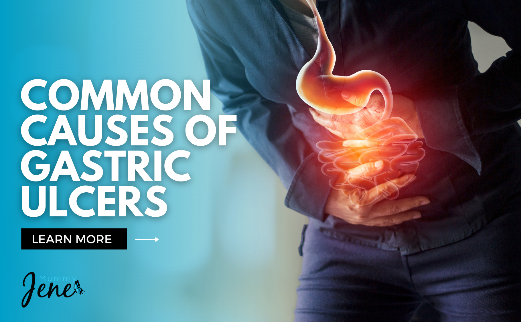 Common Causes Of Gastric Ulcers Blog Featured Image