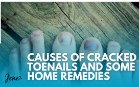 Causes Of Cracked Toenails And Some Home Remedies Blog Featured Image